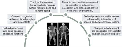 Bone Response to Weight Loss Following Bariatric Surgery